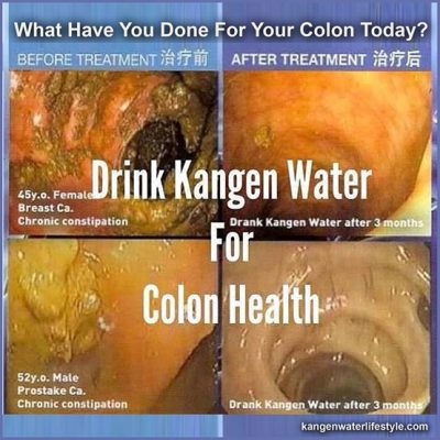 colon-health